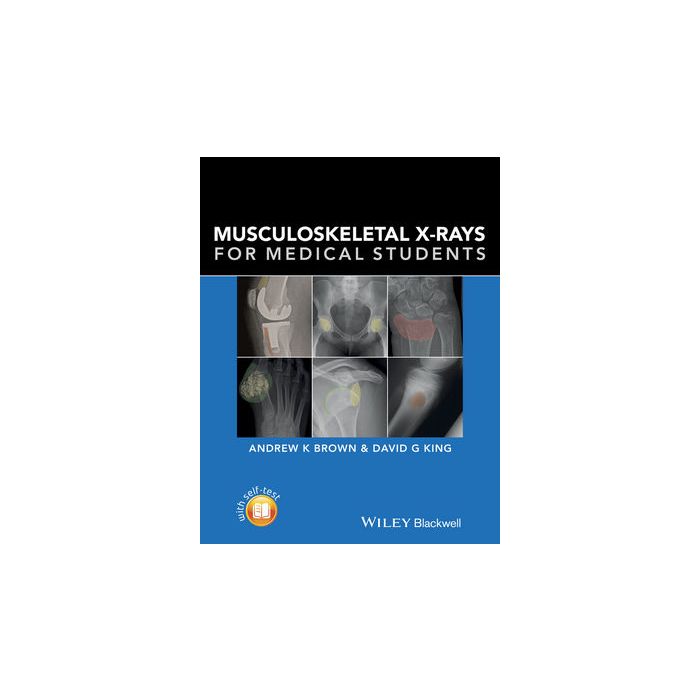 Musculoskeletal X-rays for Medical Students Brown Andrew; King David Wiley - Blackwell 9781118458730 Musculoskeletal X-rays for Medical Students Brown Andrew; King David Wiley - Blackwell 9781118458730