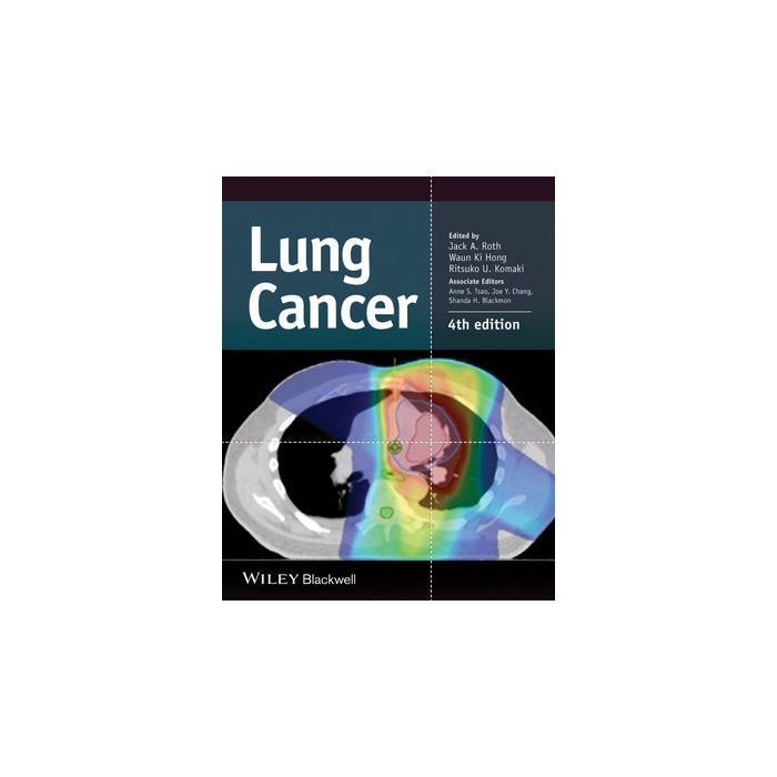 Lung Cancer, 4ed.  Roth  Jack A.; Hong Waun Ki; Komaki Ritsuko U.  Wiley - Blackwell  9781118468746
