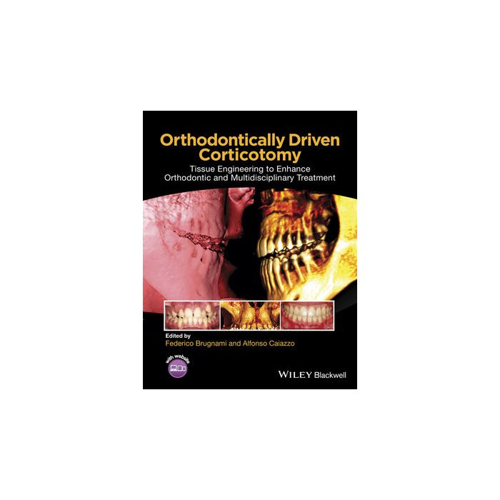 Orthodontically Driven Corticotomy: Tissue Engineering to Enhance Orthodontic and Multidisciplinary Treatment Brugnami Federico; Caiazzo Alfonso Wiley - Blackwell 9781118486870 Orthodontically Driven Corticotomy: Tissue Engineering to Enhance Orthodontic and Multidisciplinary Treatment Brugnami Federico; Caiazzo Alfonso Wiley - Blackwell 9781118486870