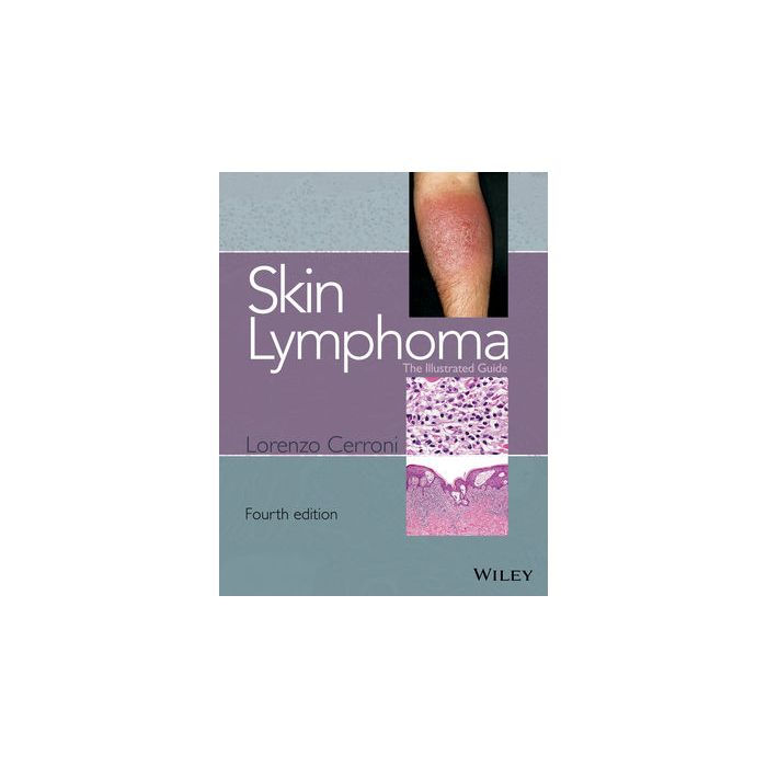Skin Lymphoma: The Illustrated Guide, 4ed. Cerroni Lorenzo Wiley - Blackwell 9781118492499 Skin Lymphoma: The Illustrated Guide, 4ed. Cerroni Lorenzo Wiley - Blackwell 9781118492499