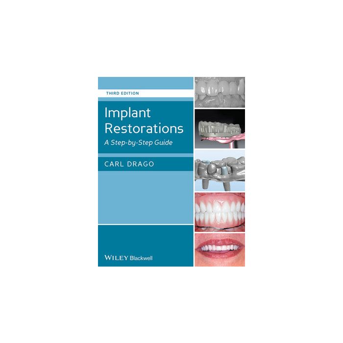 Implant Restorations: A Step-by-Step Guide, 3ed.  Drago Carl  Wiley - Blackwell  9781118513057