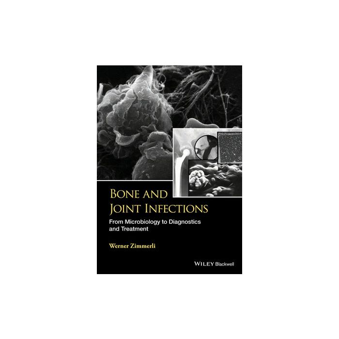 Bone and Joint Infections: From Microbiology to Diagnostics and Treatment  Zimmerli Werner  Wiley - Blackwell  9781118581773