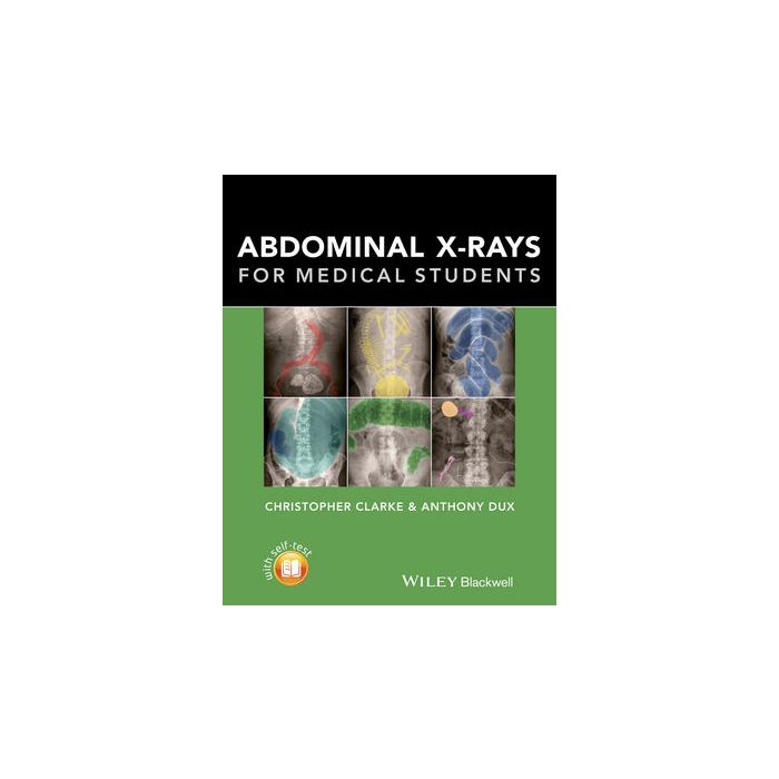Abdominal X-rays for Medical Students  Clarke Christopher; Dux Anthony  Wiley - Blackwell  9781118600559