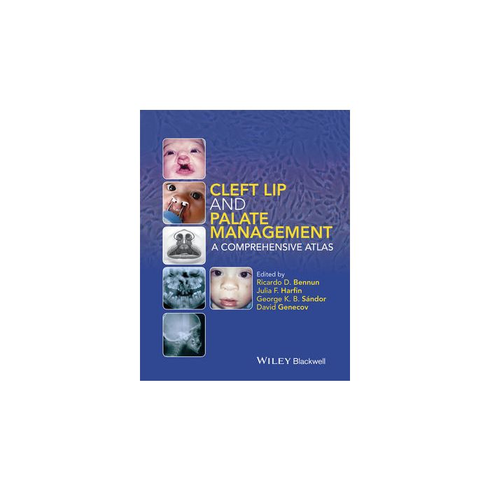 Cleft Lip and Palate Management: A Comprehensive Atlas  Bennun Ricardo D.; Harfin Julia F.; Sándor George K. B., Genecov David  Wiley - Blackwell  9781118607541