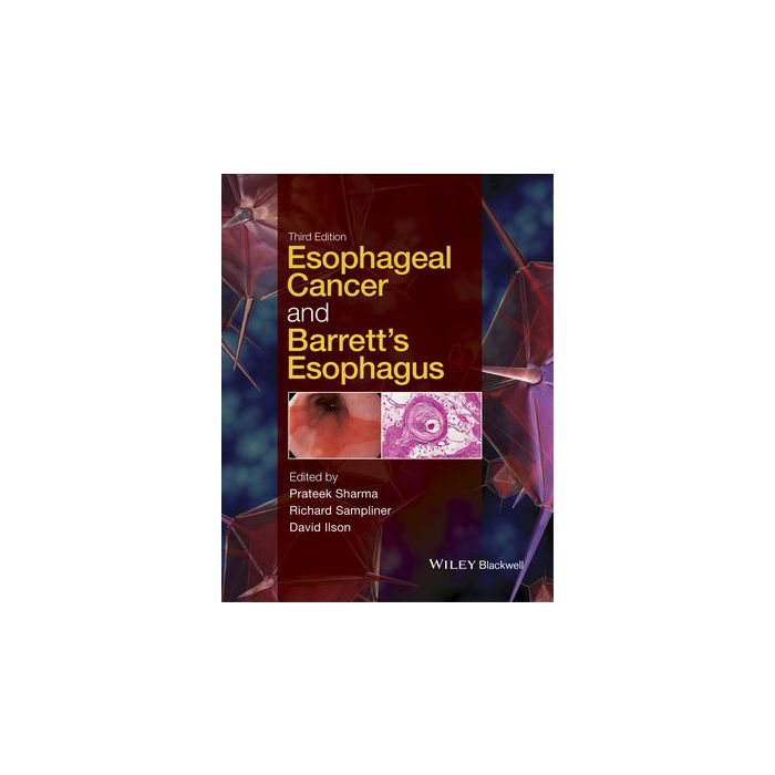 Esophageal Cancer and Barrett's Esophagus, 3ed. Sharma Prateek; Sampliner Richard; Ilson David Wiley - Blackwell 9781118655207 Esophageal Cancer and Barrett's Esophagus, 3ed. Sharma Prateek; Sampliner Richard; Ilson David Wiley - Blackwell 9781118655207