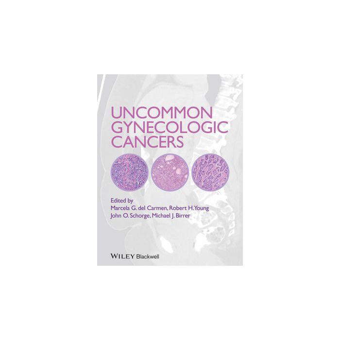 Uncommon Gynecologic Cancers  del Carmen Marcela; Schorge John O.; Young Robert H.  Wiley - Blackwell  9781118655351