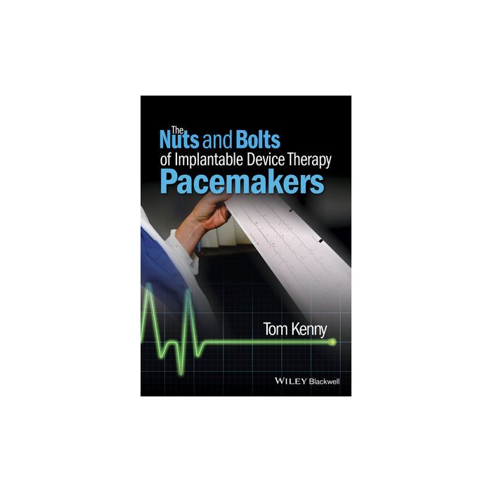 The Nuts and Bolts of Implantable Device Therapy: Pacemakers Kenny Tom Wiley - Blackwell 9781118670675 The Nuts and Bolts of Implantable Device Therapy: Pacemakers Kenny Tom Wiley - Blackwell 9781118670675