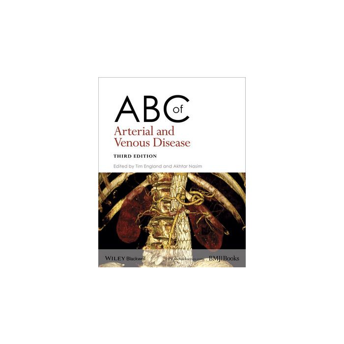 ABC of Arterial and Venous Disease, 3ed.  England Tim; Nasim Akhtar  Wiley - Blackwell  9781118740682