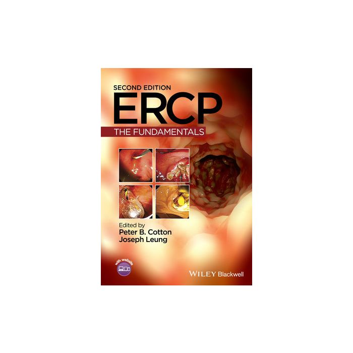 ERCP: The Fundamentals, 2ed.  Cotton Peter B.; Leung Joseph W.  Wiley - Blackwell  9781118769416