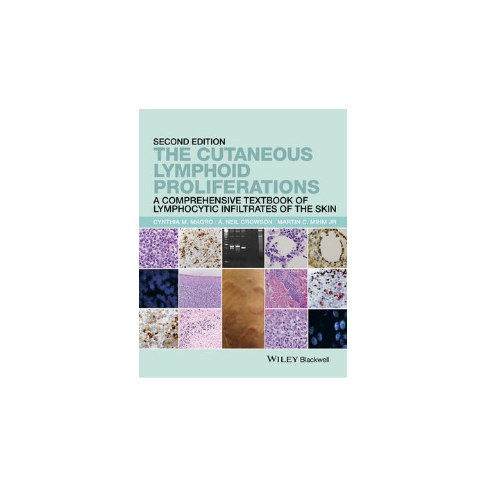 The Cutaneous Lymphoid Proliferations: A Comprehensive Textbook of Lymphocytic Infiltrates of the Skin, 2ed. Magro Cynthia M.; Crowson A. Neil; Mihm Martin C. Wiley - Blackwell 9781118776261 The Cutaneous Lymphoid Proliferations: A Comprehensive Textbook of Lymphocytic Infiltrates of the Skin, 2ed. Magro Cynthia M.; Crowson A. Neil; Mihm Martin C. Wiley - Blackwell 9781118776261