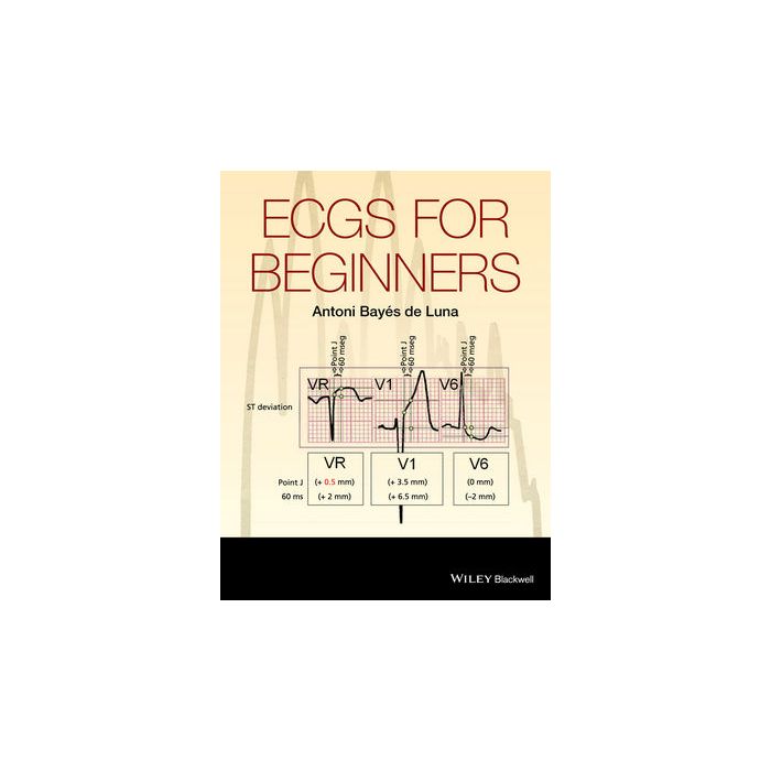 ECGs for Beginners  Bayes de Luna Antoni  Wiley - Blackwell  9781118821312