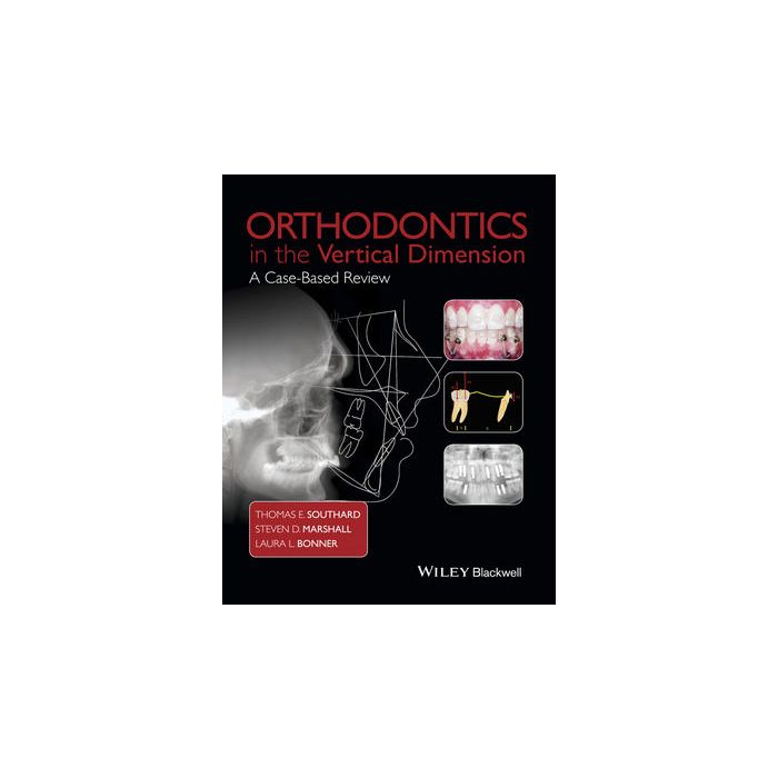 Orthodontics in the Vertical Dimension: A Case-Based Review  Southard Thomas E.; Marshall Steven D.; Bonner Laura L.  Wiley - Blackwell  9781118870211