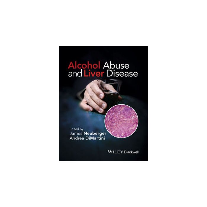 Alcohol Abuse and Liver Disease Neuberger James; DiMartini Andrea Wiley - Blackwell 9781118887288 Alcohol Abuse and Liver Disease Neuberger James; DiMartini Andrea Wiley - Blackwell 9781118887288