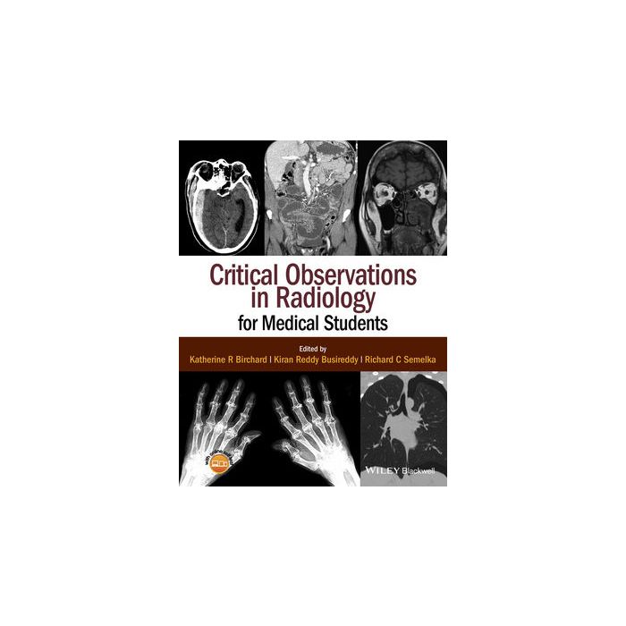 Critical Observations in Radiology for Medical Students Birchard Katherine R.; Busireddy Kiran Reddy; Semelka Richard C. Wiley - Blackwell 9781118904718 Critical Observations in Radiology for Medical Students Birchard Katherine R.; Busireddy Kiran Reddy; Semelka Richard C. Wiley - Blackwell 9781118904718
