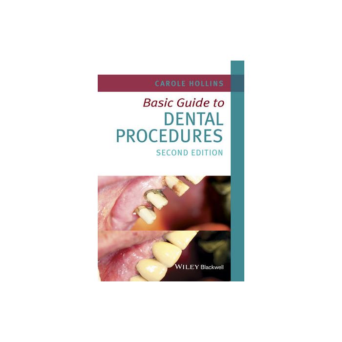 Basic Guide to Dental Procedures, 2ed.  Hollins Carole  Wiley - Blackwell  9781118924556