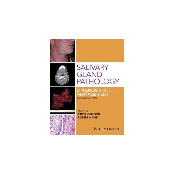 Salivary Gland Pathology: Diagnosis and Management, 2ed.  Carlson Eric; Ord Robert A.  Wiley - Blackwell  9781118933756