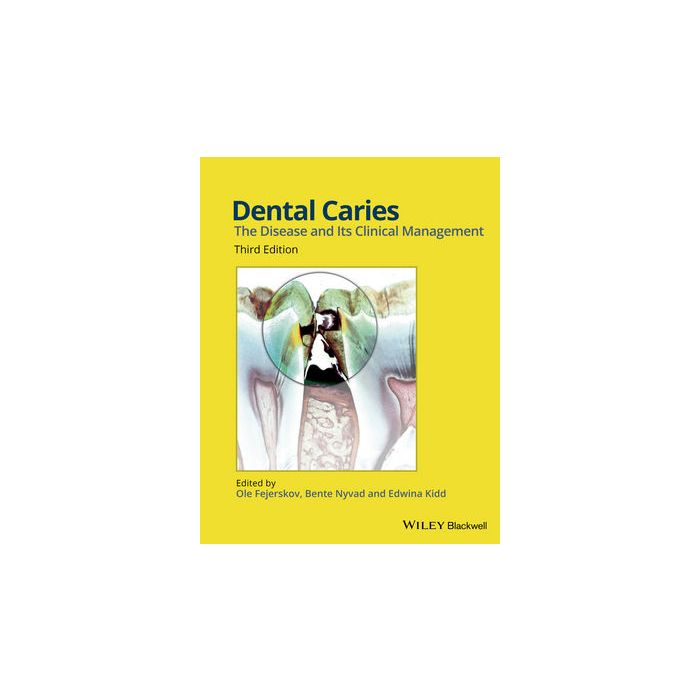Dental Caries: The Disease and its Clinical Management, 3ed. Fejerskov Ole; Nyvad Bente; Kidd Edwina Wiley - Blackwell 9781118935828 Dental Caries: The Disease and its Clinical Management, 3ed. Fejerskov Ole; Nyvad Bente; Kidd Edwina Wiley - Blackwell 9781118935828