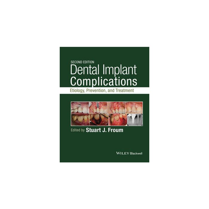 Dental Implant Complications: Etiology, Prevention, and Treatment, 2ed. Froum Stuart J. Wiley - Blackwell 9781118976456 Dental Implant Complications: Etiology, Prevention, and Treatment, 2ed. Froum Stuart J. Wiley - Blackwell 9781118976456