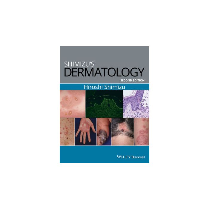 Shimizu's Dermatology, 2ed. Shimizu Hiroshi Wiley - Blackwell 9781119099055 Shimizu's Dermatology, 2ed. Shimizu Hiroshi Wiley - Blackwell 9781119099055