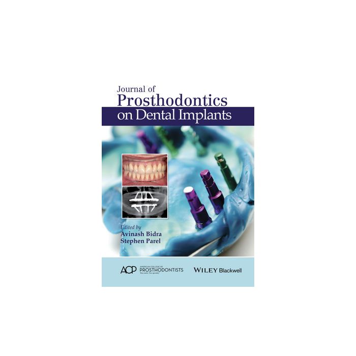 Journal of Prosthodontics on Dental Implants  Bidra Avinash S.; Parel Stephen M.  Wiley - Blackwell  9781119115366