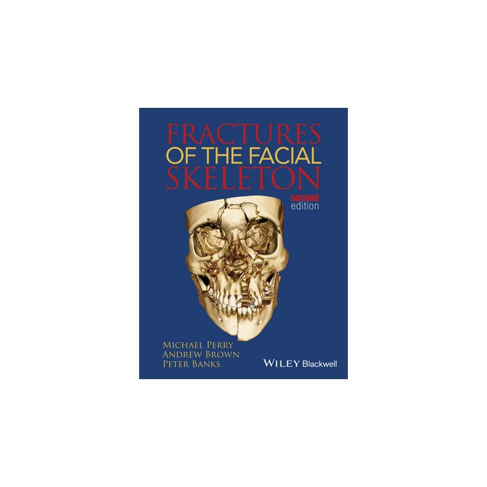Fractures of the Facial Skeleton, 2ed. Perry Michael; Brown Andrew; Banks Peter Wiley - Blackwell 9781119967668 Fractures of the Facial Skeleton, 2ed. Perry Michael; Brown Andrew; Banks Peter Wiley - Blackwell 9781119967668