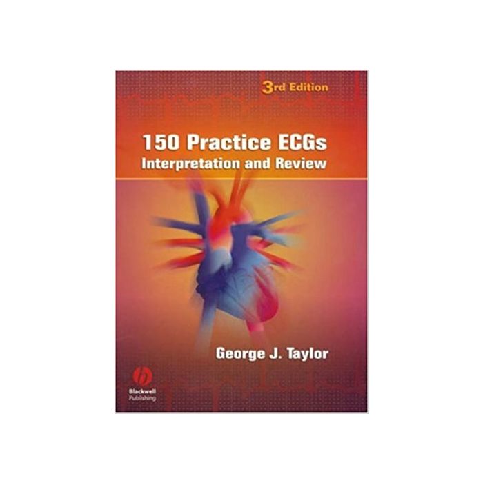 150 practice ECGs Interpretation and Review