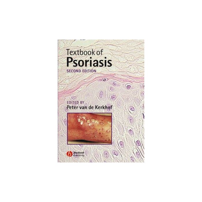 Textbook of Psoriasis, 2ed.  Van de Kerkhof Peter C. M.  Wiley - Blackwell  9781405107174