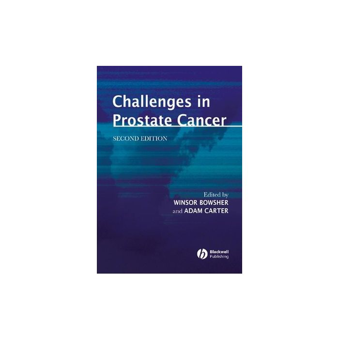 Challenges in Prostate Cancer, 2ed. Bowsher Winsor; Carter Adam Wiley - Blackwell 9781405107525 Challenges in Prostate Cancer, 2ed. Bowsher Winsor; Carter Adam Wiley - Blackwell 9781405107525