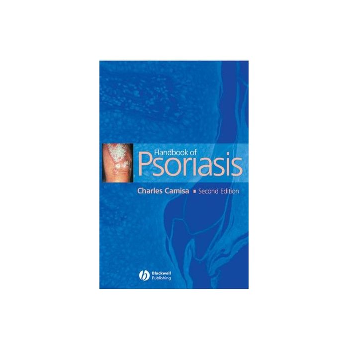 Handbook of Psoriasis, 2ed.  Camisa Charles  Wiley - Blackwell  9781405109277