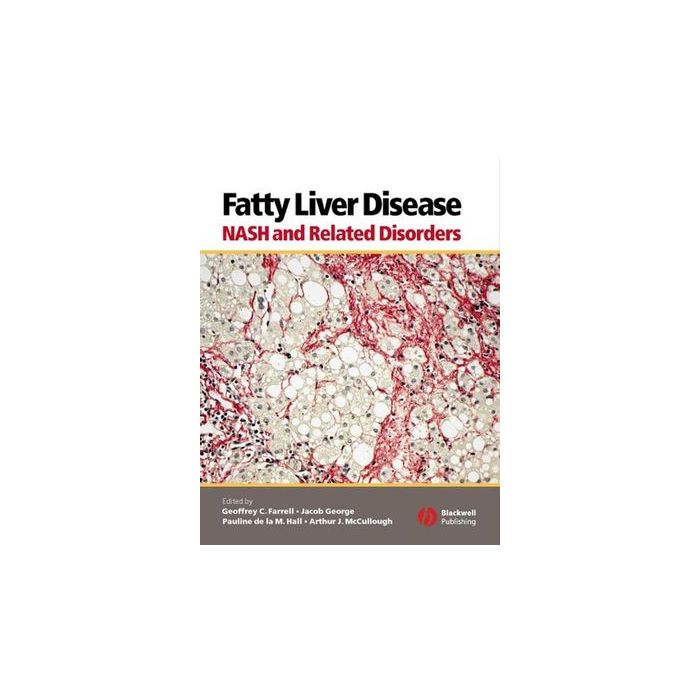 Fatty Liver Disease: NASH and Related Disorders  Farrell Geoffrey C.; George Jacob; Hall Pauline de la M.; McCullough Arthur J.  Wiley - Blackwell  9781405112925