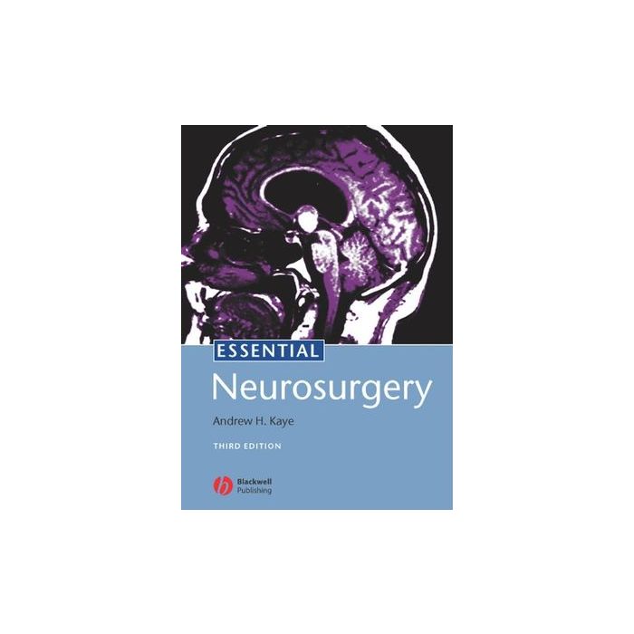Essential Neurosurgery, 3ed. Kaye Andrew H. Wiley - Blackwell 9781405116411 Essential Neurosurgery, 3ed. Kaye Andrew H. Wiley - Blackwell 9781405116411