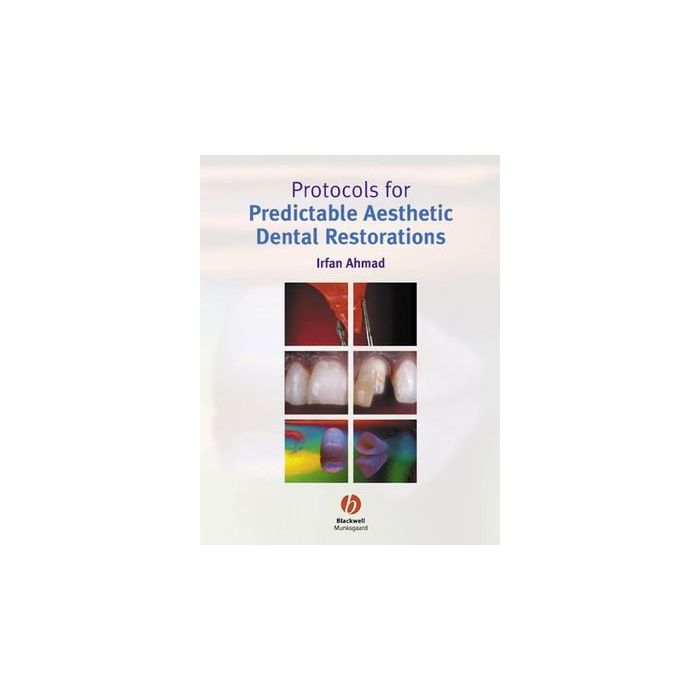 Protocols for Predictable Aesthetic Dental Restorations  Ahmad Irfan  Wiley - Blackwell  9781405118200