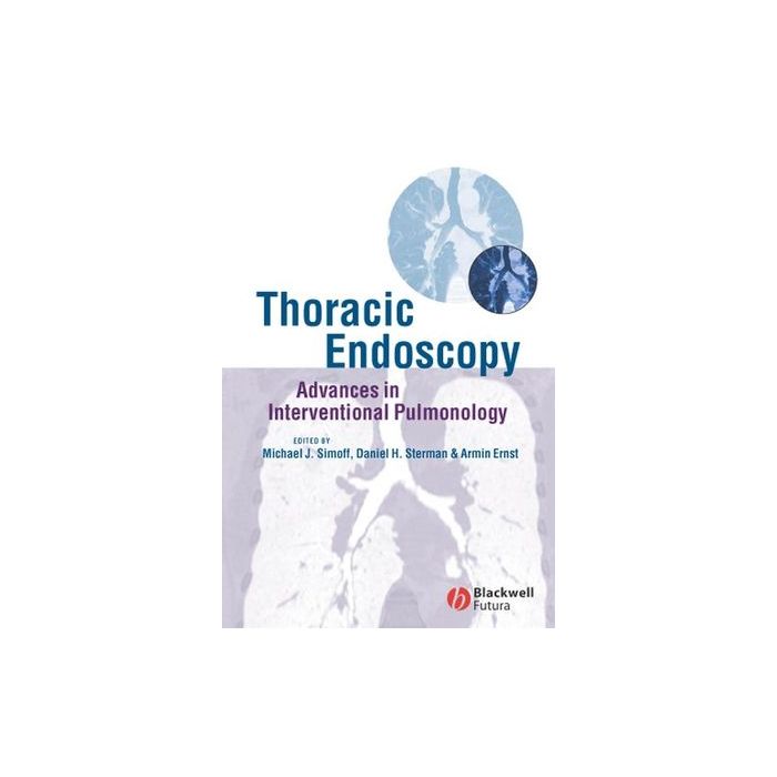 Thoracic Endoscopy: Advances in Interventional Pulmonology  Simoff Michael J.; Sterman Daniel H.; Ernst Armin  Wiley - Blackwell  9781405122047