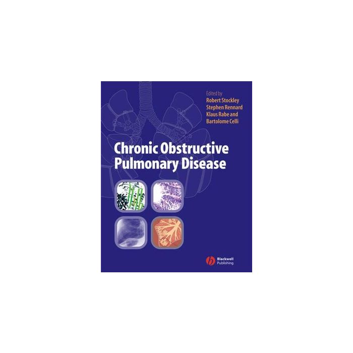 Chronic Obstructive Pulmonary Disease: A Practical Guide to Management  Stockley Robert A.; Rennard Stephen; Rabe Klaus; Celli Bartolome  Wiley - Blackwell  9781405122894