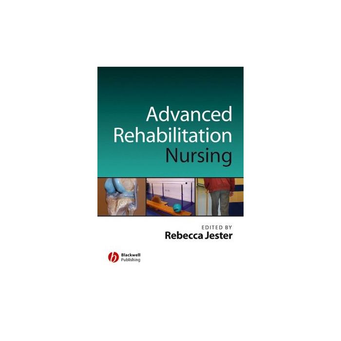 Advancing Practice in Rehabilitation Nursing Jester Rebecca Wiley - Blackwell 9781405125086 Advancing Practice in Rehabilitation Nursing Jester Rebecca Wiley - Blackwell 9781405125086