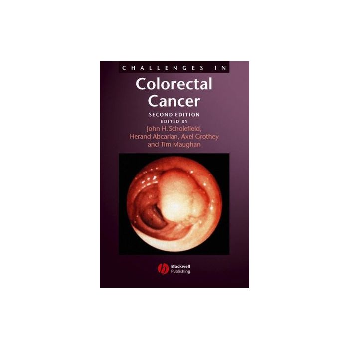 Challenges in Colorectal Cancer, 2ed.  Scholefield John; Abcarian Herand; Maughan Tim; rothey Axel  Wiley - Blackwell  9781405127066