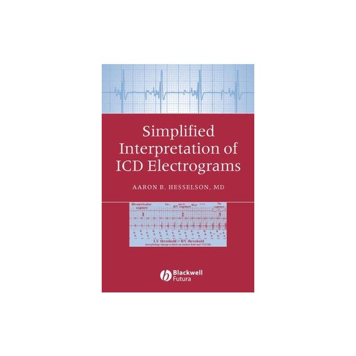 Simplified Interpretation of ICD Electrograms Hesselson Aaron B. Wiley - Blackwell 9781405127318 Simplified Interpretation of ICD Electrograms Hesselson Aaron B. Wiley - Blackwell 9781405127318