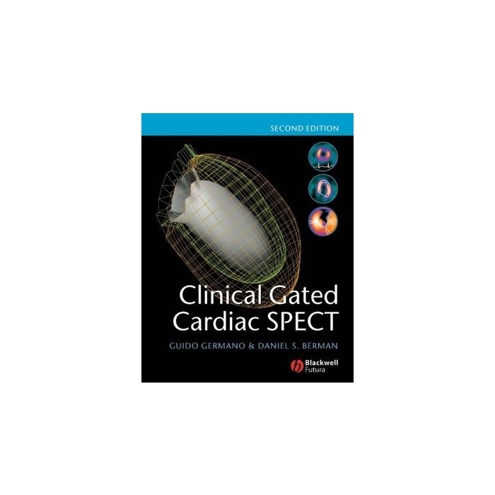 Clinical Gated Cardiac SPECT, 2ed. Germano Guido; Berman Daniel S. Wiley - Blackwell 9781405131551 Clinical Gated Cardiac SPECT, 2ed. Germano Guido; Berman Daniel S. Wiley - Blackwell 9781405131551