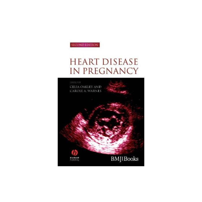 Heart Disease in Pregnancy, 2ed.  Oakley Celia; Warnes Carole A.  Wiley - Blackwell  9781405134880