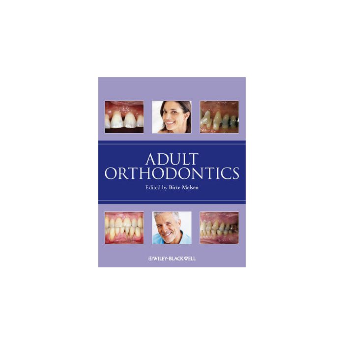 Adult Orthodontics Melsen Birte Wiley - Blackwell 9781405136198 Adult Orthodontics Melsen Birte Wiley - Blackwell 9781405136198
