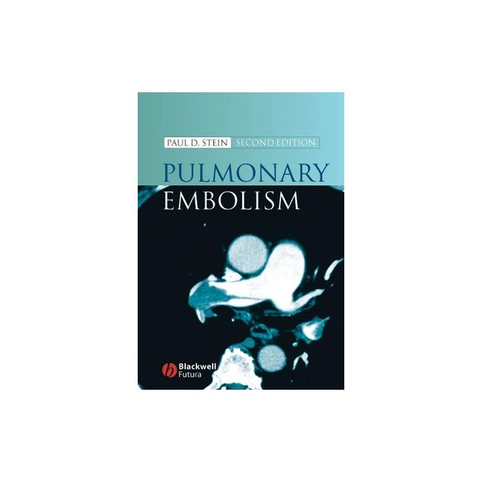 Pulmonary Embolism, 2ed.  Stein Paul  Wiley - Blackwell  9781405138079