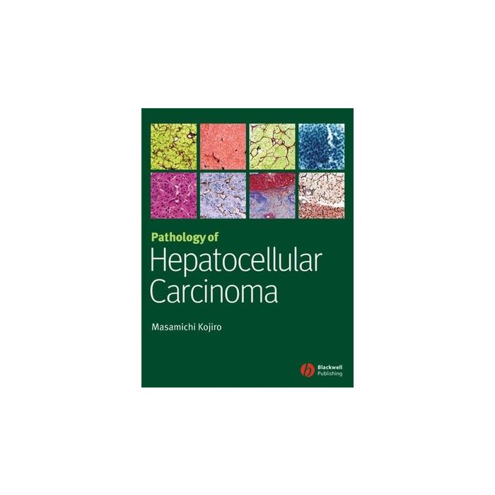 Pathology of Hepatocellular Carcinoma  Kojiro Masamichi  Wiley - Blackwell  9781405139083