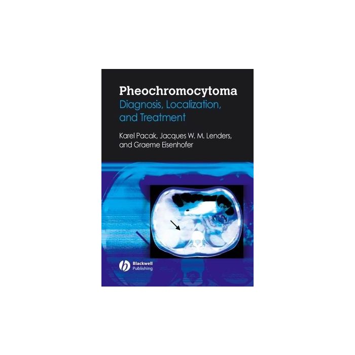 Pheochromocytoma: Diagnosis, Localization, and Treatment  Pacak Karel; Eisenhofer Graeme; Lenders Jacques  Wiley - Blackwell  9781405149501