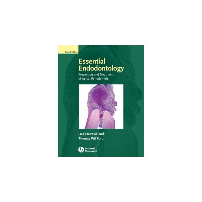 Essential Endodontology: Prevention and Treatment of Apical Periodontitis, 2ed. Orstavik Dag; Ford Thomas Pitt Wiley - Blackwell 9781405149761 Essential Endodontology: Prevention and Treatment of Apical Periodontitis, 2ed. Orstavik Dag; Ford Thomas Pitt Wiley - Blackwell 9781405149761