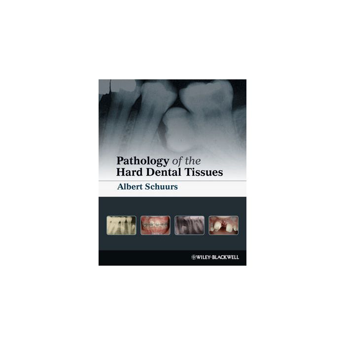 Pathology of the Hard Dental Tissues Schuurs Albert Wiley - Blackwell 9781405153652 Pathology of the Hard Dental Tissues Schuurs Albert Wiley - Blackwell 9781405153652
