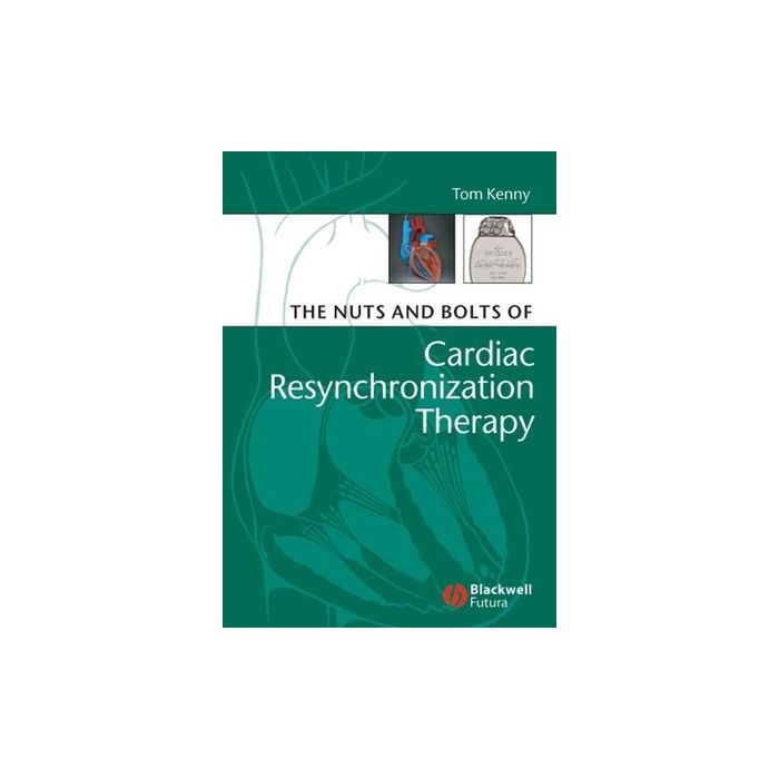 The Nuts and Bolts of Cardiac Resynchronization Therapy  Kenny Tom  Wiley - Blackwell  9781405153720