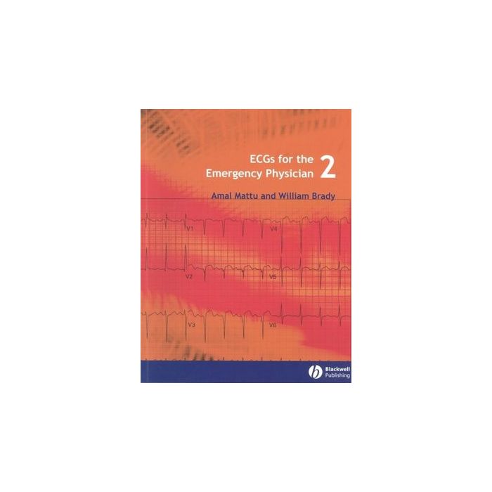 ECGs for the Emergency Physician 2 Mattu Amal; Brady William J. Wiley - Blackwell 9781405157018 ECGs for the Emergency Physician 2 Mattu Amal; Brady William J. Wiley - Blackwell 9781405157018