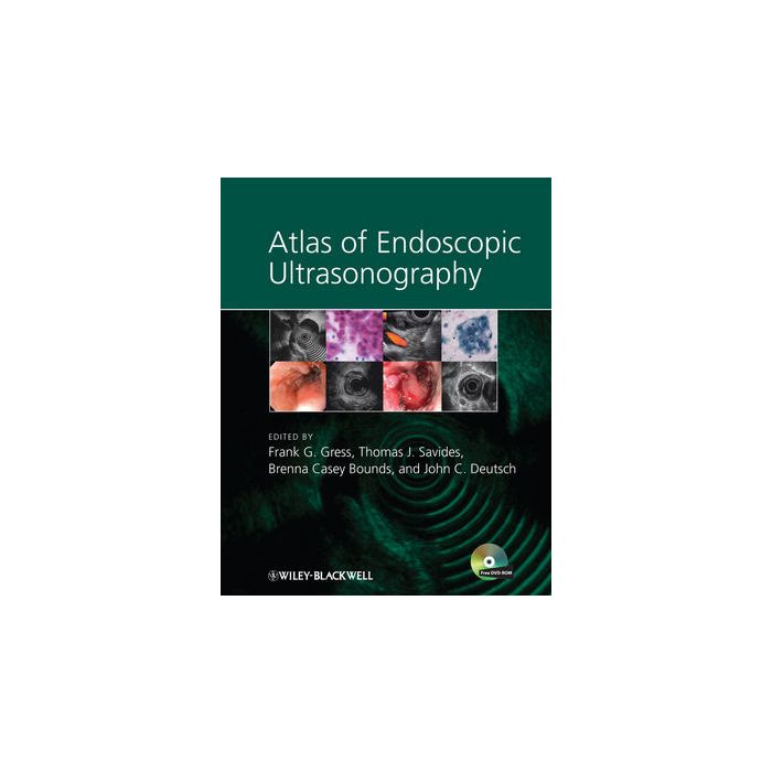 Atlas of Endoscopic Ultrasonography Gress Frank; Savides Thomas; Bounds Brenna C.; Deutsch John C. Wiley - Blackwell 9781405157216 Atlas of Endoscopic Ultrasonography Gress Frank; Savides Thomas; Bounds Brenna C.; Deutsch John C. Wiley - Blackwell 9781405157216