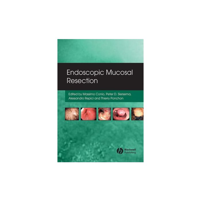 Endoscopic Mucosal Resection Conio Massimo; Siersema Pieter; Repici Alessandro; Ponchon Thierry Wiley - Blackwell 9781405158855 Endoscopic Mucosal Resection Conio Massimo; Siersema Pieter; Repici Alessandro; Ponchon Thierry Wiley - Blackwell 9781405158855
