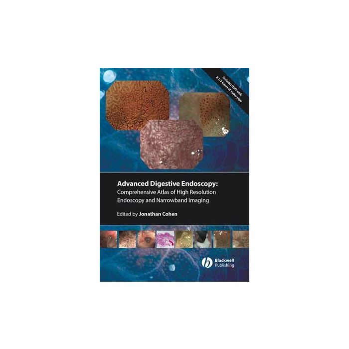 Comprehensive Atlas of High Resolution Endoscopy and Narrowband Imaging  Cohen Jonathan  Wiley - Blackwell  9781405158862